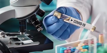 Puluhan Litbangkes Dikerahkan Antisipasi Strain Virus Baru