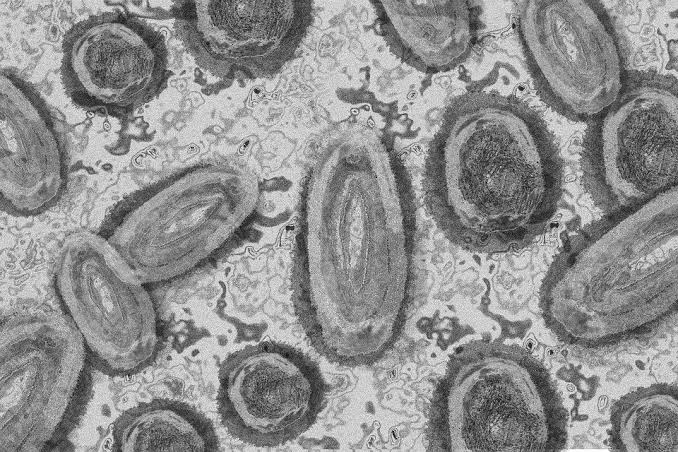 Virus Cacar Monyet Bermutasi Lebih Cepat, Ini Alasannya